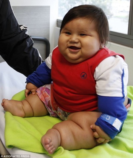 Eight-month-old Santiago Mendoza weighs 19.7kg